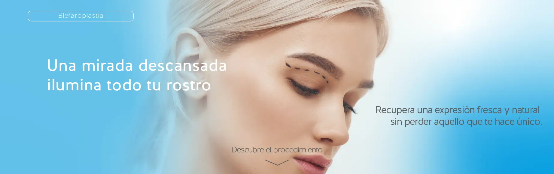 Blefaroplastia en Manizales - Dr. Daniel Varón