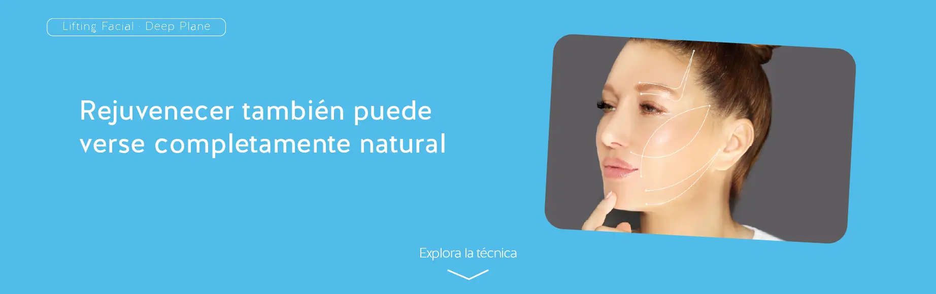 Lifting facial en Manizales - Dr. Daniel Varón, técnica Deep Plane