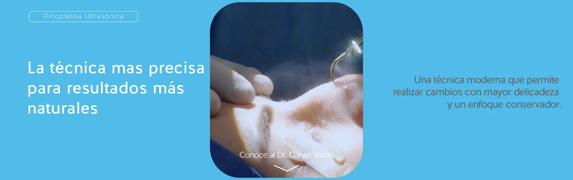 Rinoplastia ultrasónica en manizales dr. Daniel varón
